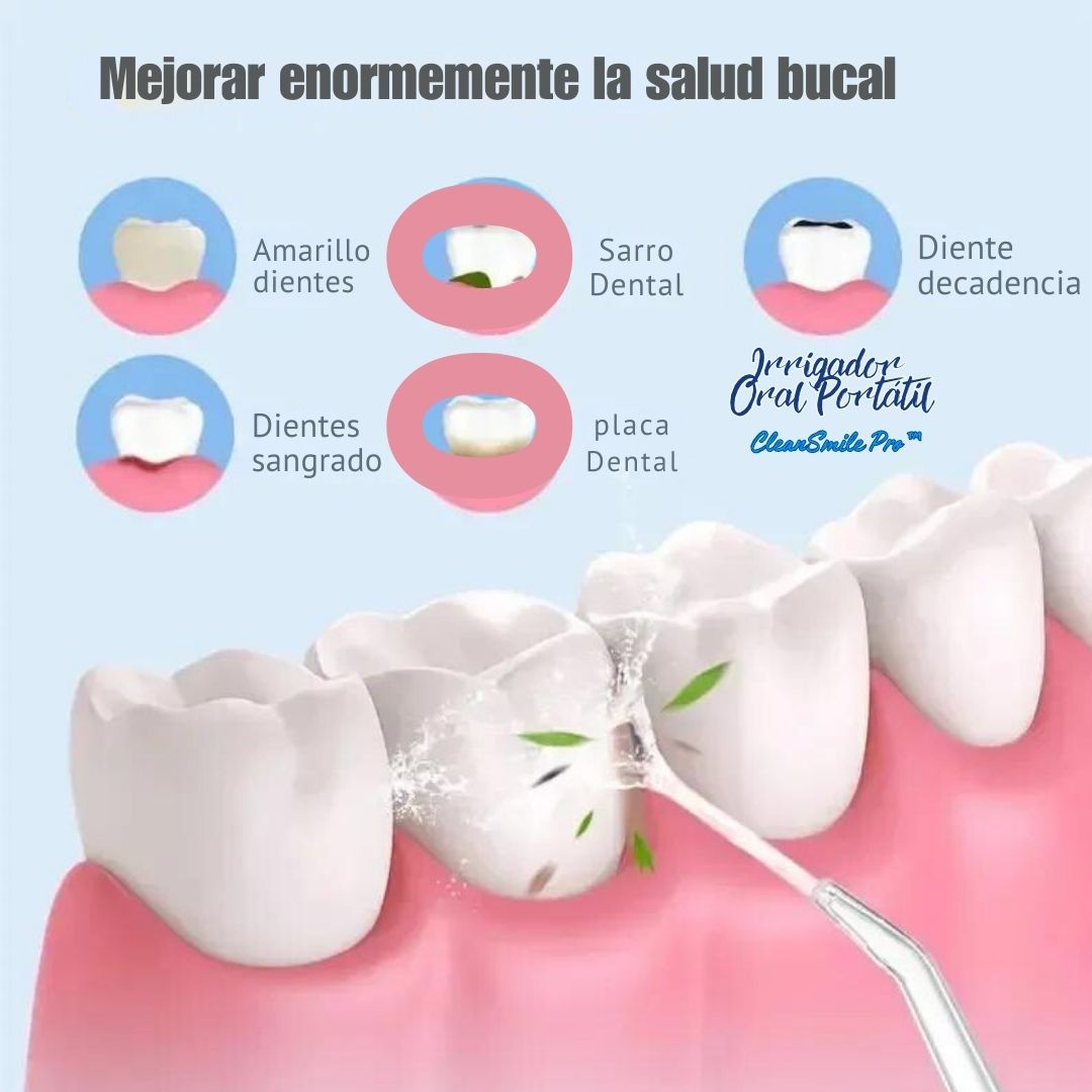 Irrigador Dental Portátil Recargable – Limpieza Profunda y Sin Dolor 🦷💧