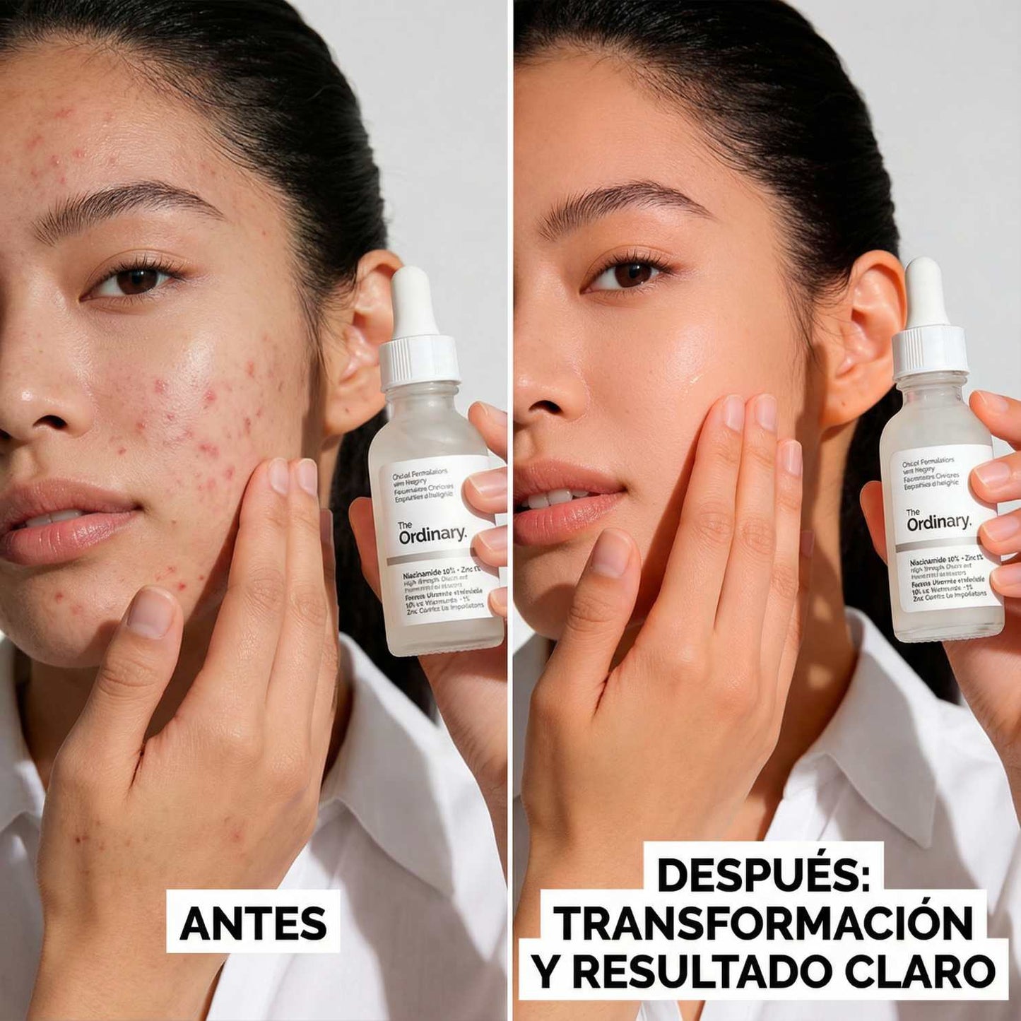 The Ordinary Niacinamide 10% + Zinc 1% – 30 ml ✨