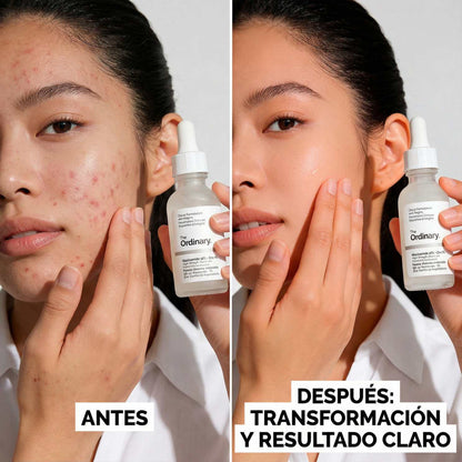 The Ordinary Niacinamide 10% + Zinc 1% – 30 ml ✨