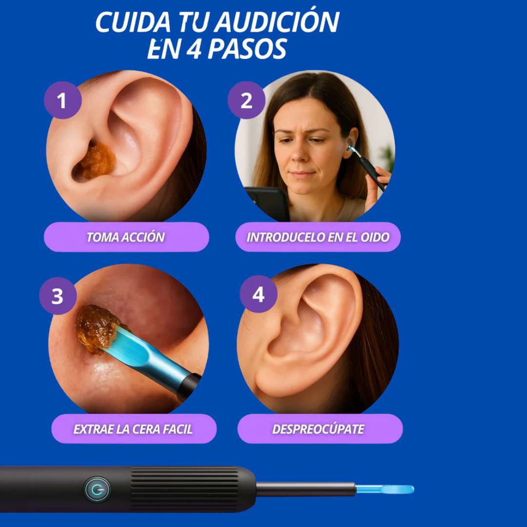 Limpiador de Oídos con Cámara HD™ – Protege tu audición sin riesgos 👂📸