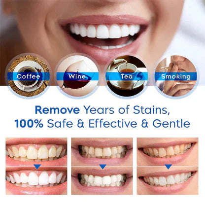 Dazzling White™ Lápiz Blanqueador Dental
