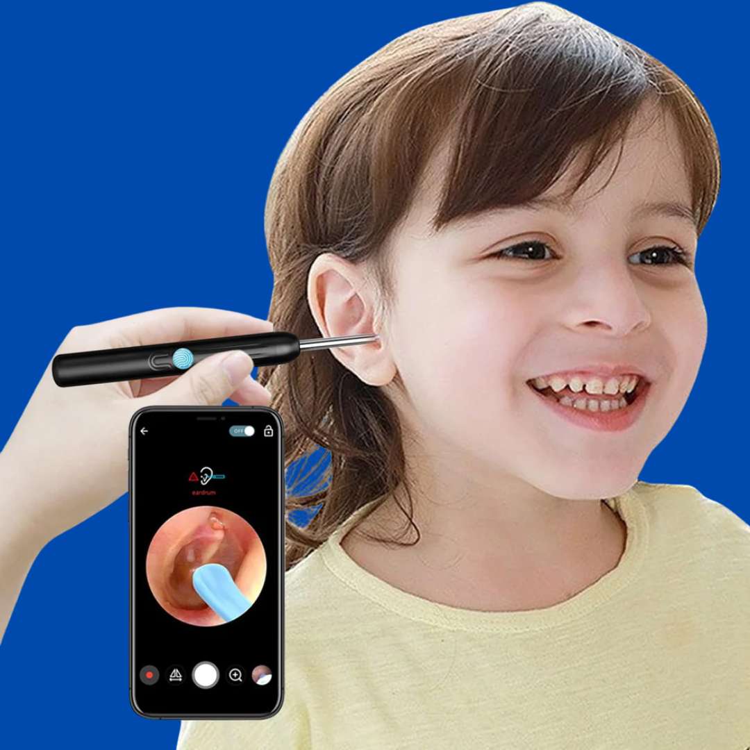 Limpiador de Oídos con Cámara HD™ – Protege tu audición sin riesgos 👂📸