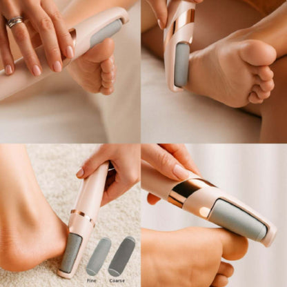 SmoothFeet Pro™ – Removedor Eléctrico de Callos y Durezas 👣