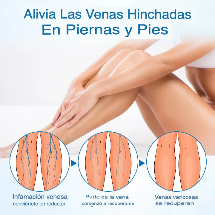 Timilk® VeinGuard™ Spray x 1 (30 ml) — Alivio y soporte microcirculatorio 🌿