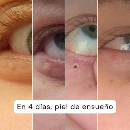 Alcura™ Full Pack – Solución total desde casa 🏠