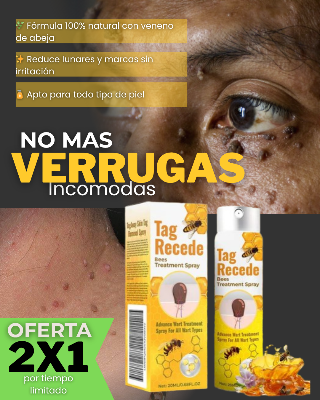 Elimina Verrugas Pro™ Pague 1 lleve 2  (0.7 fl oz) – Piel libre y segura 🌿