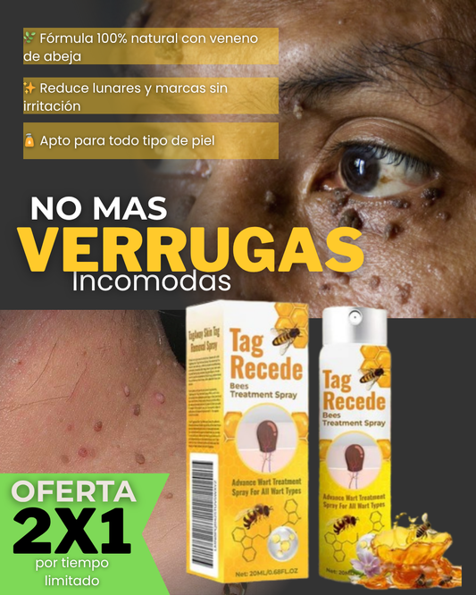 Elimina Verrugas Pro™ Pague 1 lleve 2  (0.7 fl oz) – Piel libre y segura 🌿