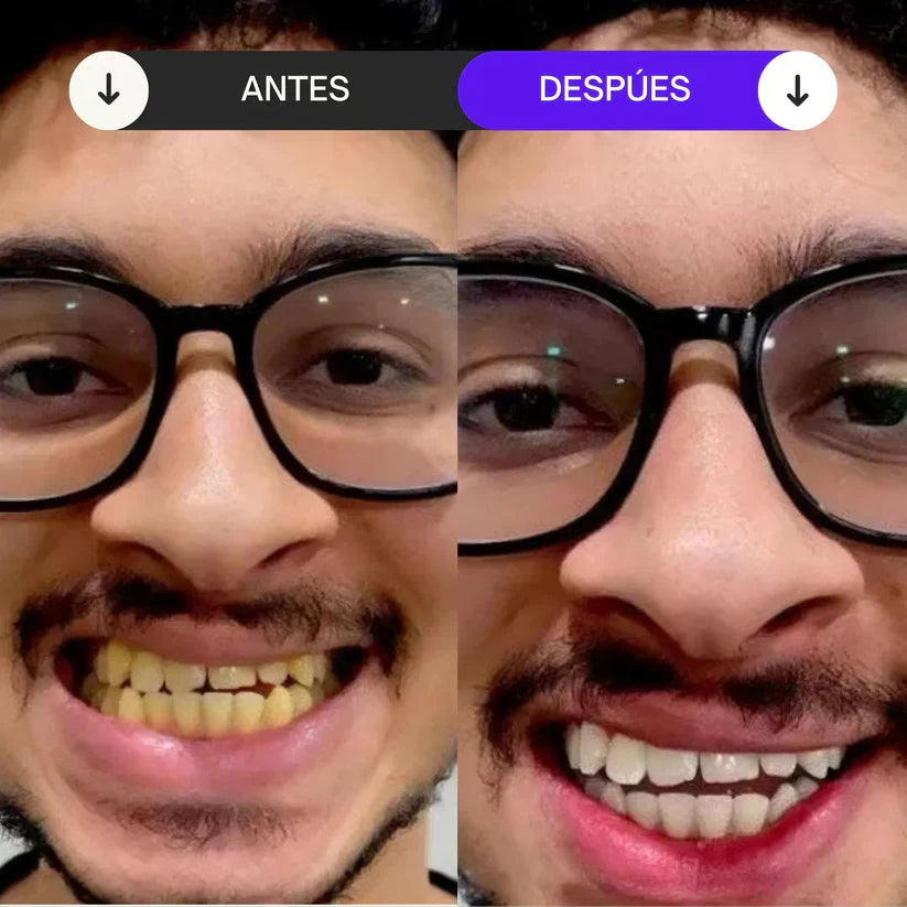 HiSmile™ Original — Espuma Blanqueadora + Cepillo (Obsequio) ✨