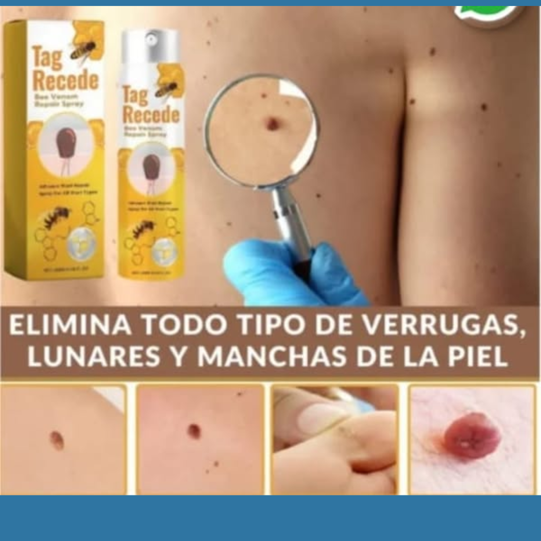 Elimina Verrugas Pro™ Pague 1 lleve 2  (0.7 fl oz) – Piel libre y segura 🌿