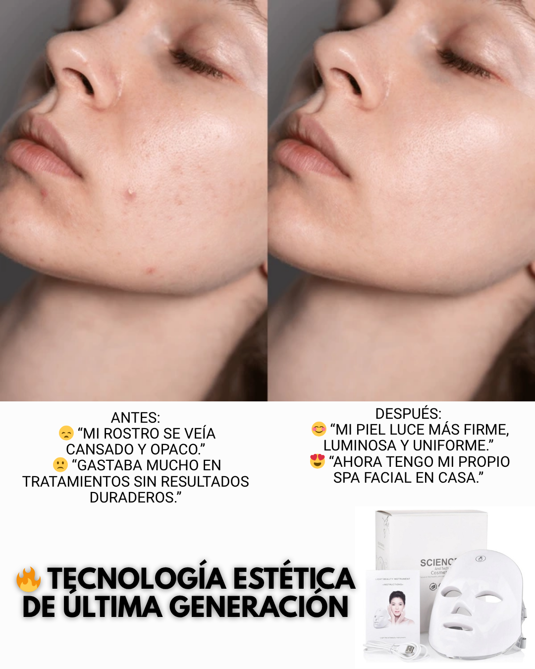 Máscara LED Facial Rejuvenecedora™ – Piel radiante sin esfuerzo 💆‍♀️