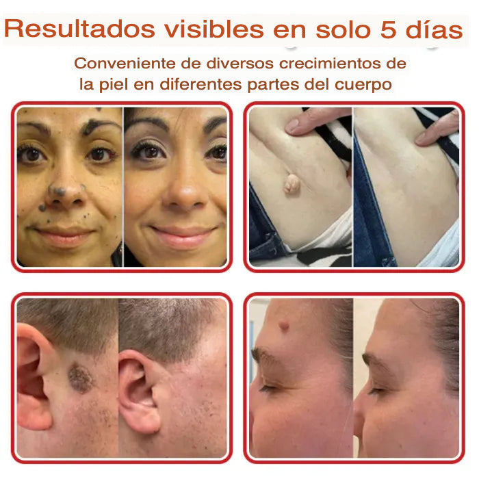 Encabezado