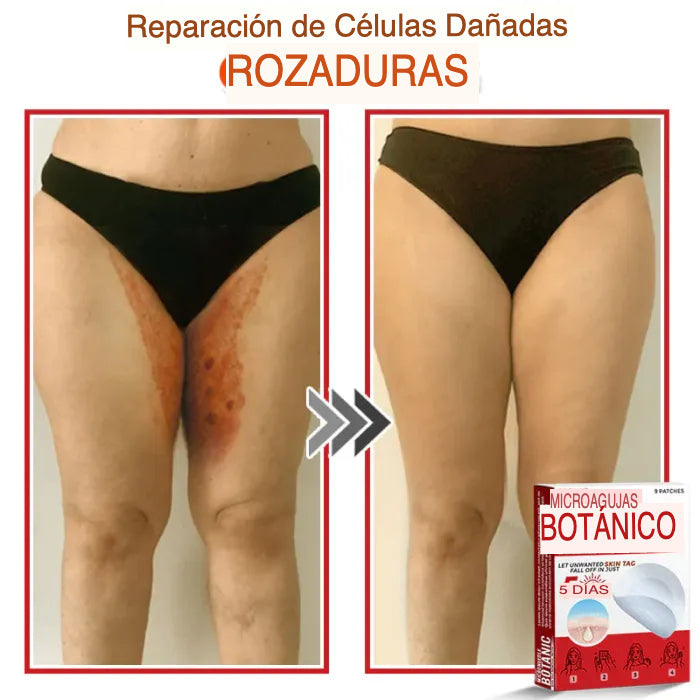 Belbexa Patch™ – Bienestar Natural 🌿